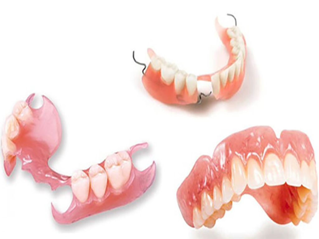 Hàm giả tháo lắp là phương pháp phục hình răng tiết kiệm chi phí